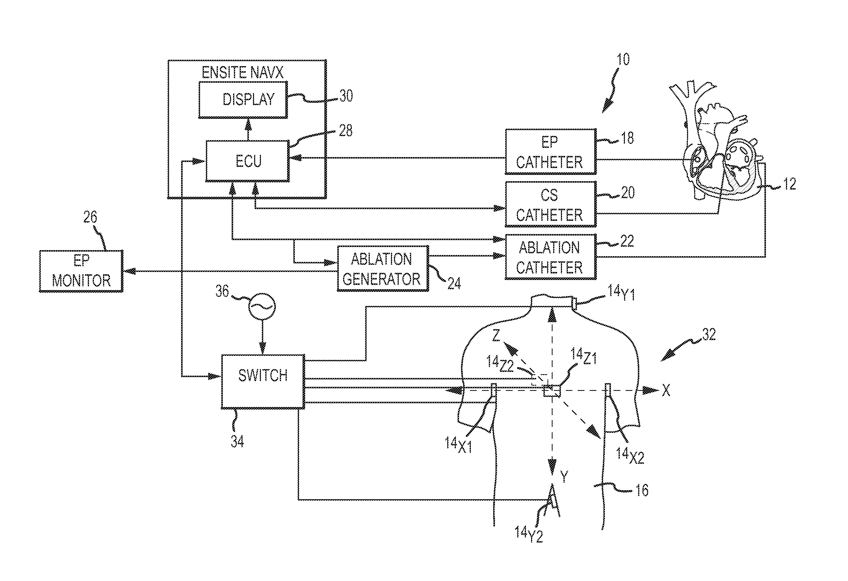 System and method for treating arrhythmias in the heart using information obtained from heart wall motion