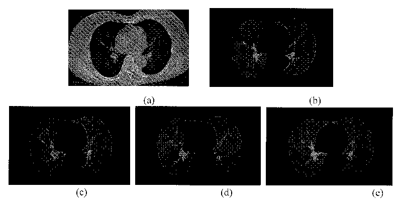 Three-dimensional image segmentation method based on three-dimensional improved pulse coupled neural network