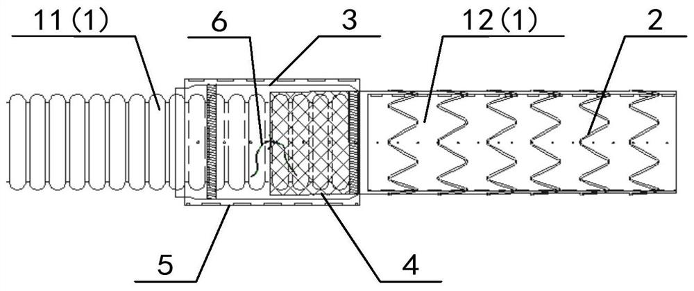 Suture-free stent graft