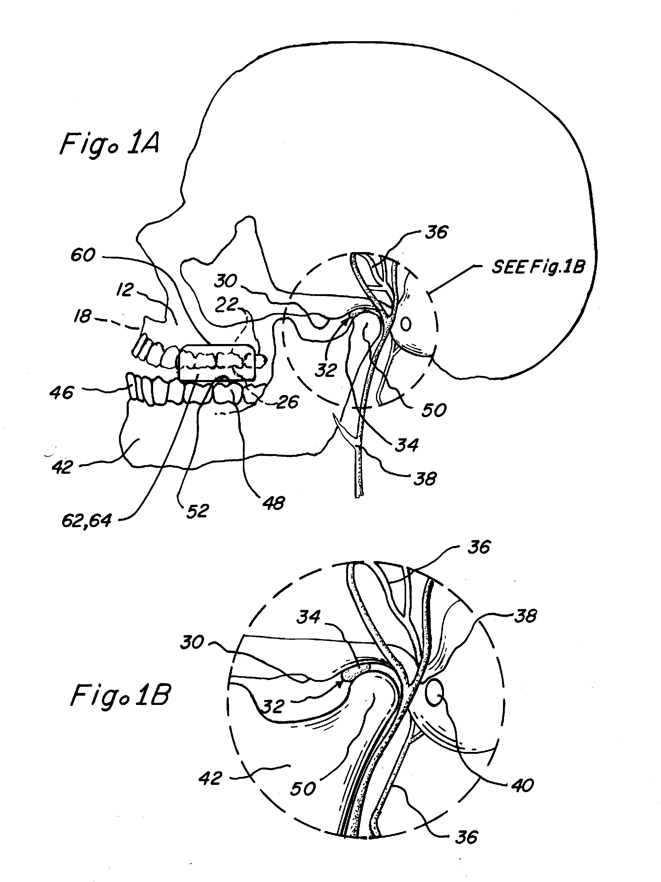Methods and Apparatus for Reduction of Cortisol