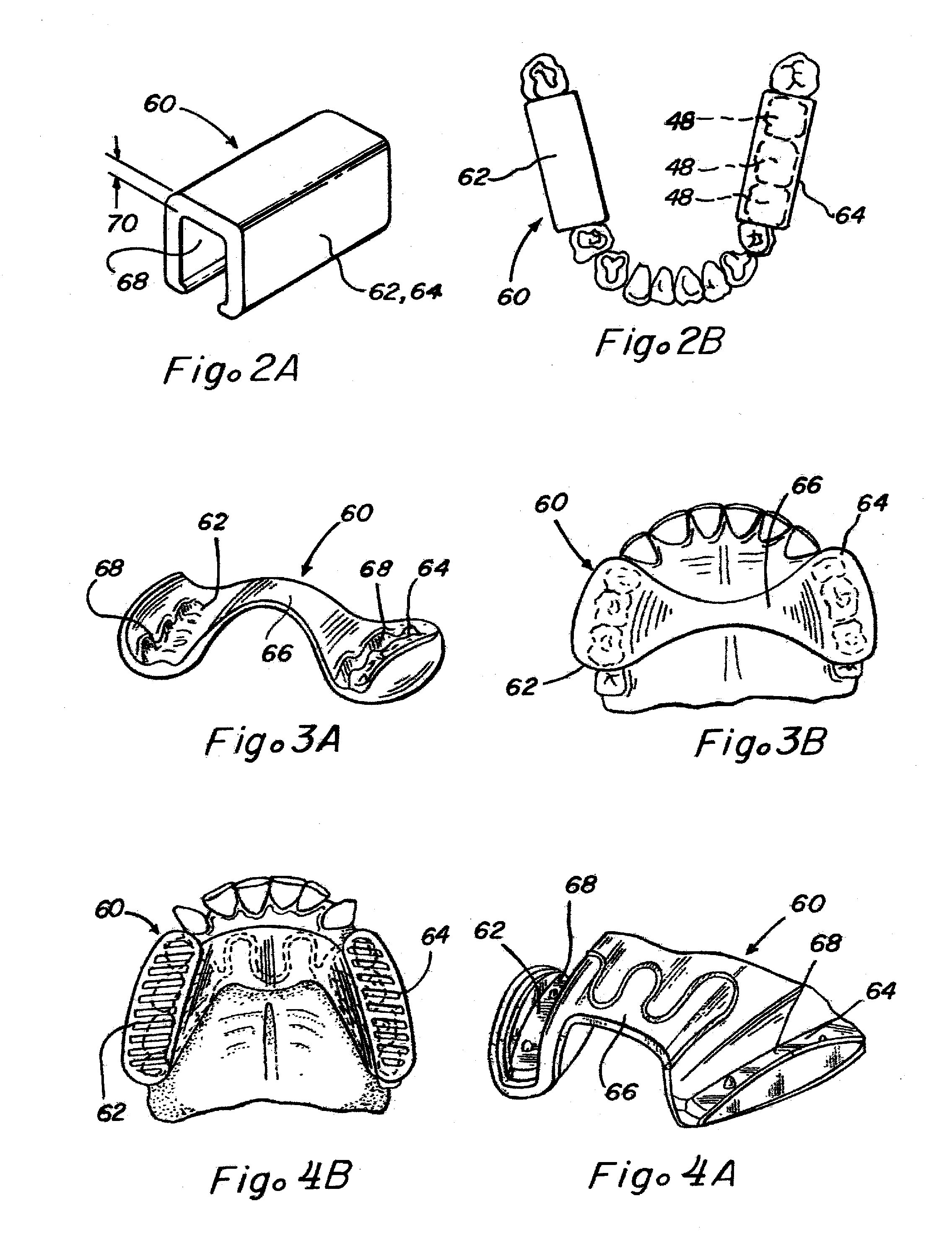 Methods and Apparatus for Reduction of Cortisol
