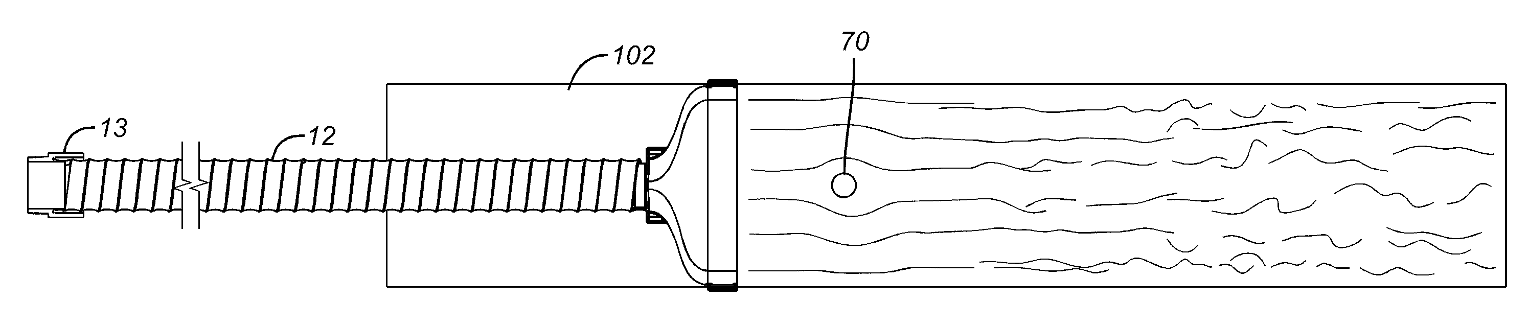 Apparatus and Method for Reducing Contamination of Surgical Sites