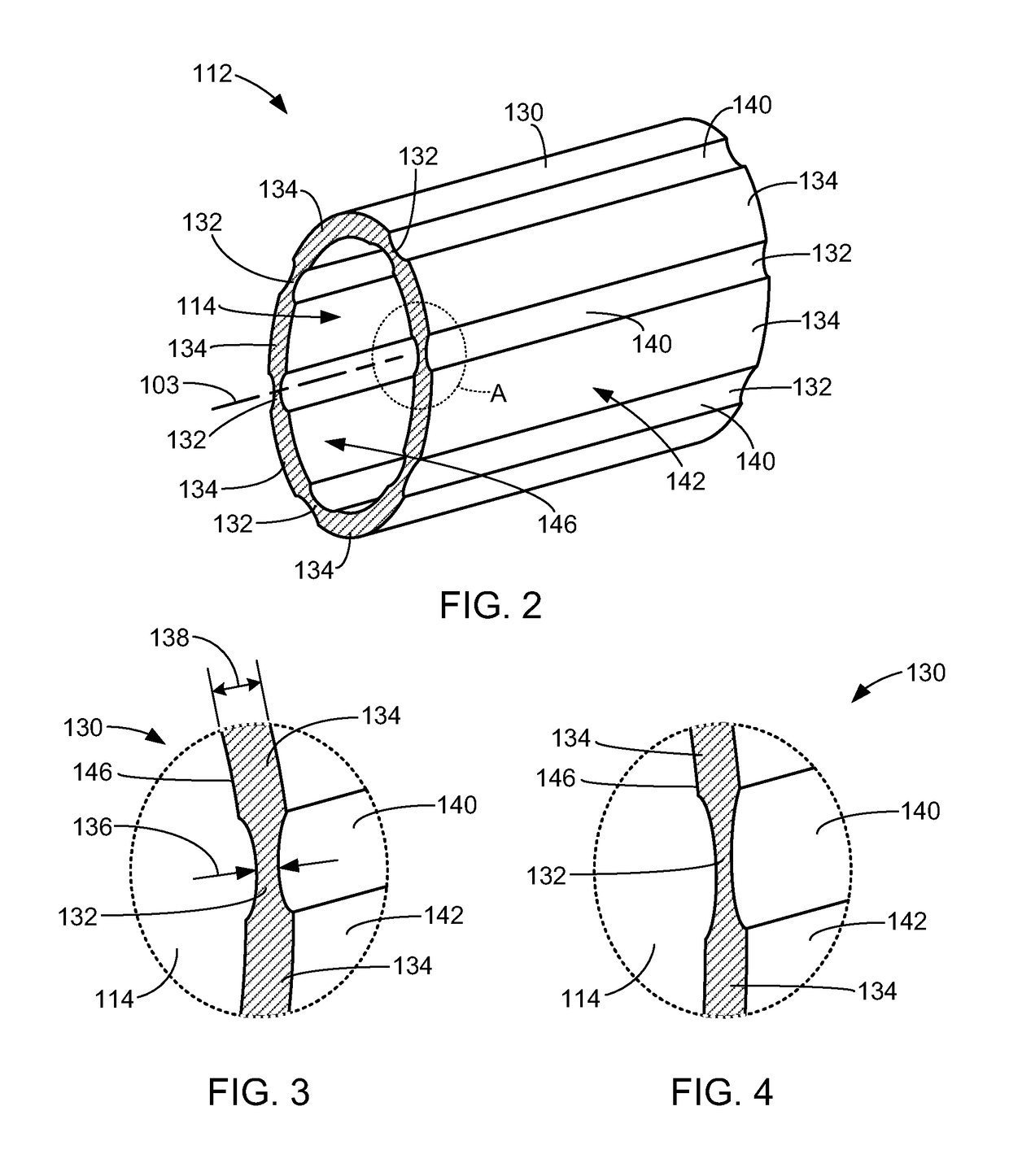 Girth expanding penile prosthesis cylinder