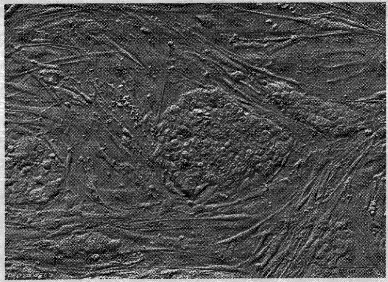 Isolation method of porcine cumulus stem cells