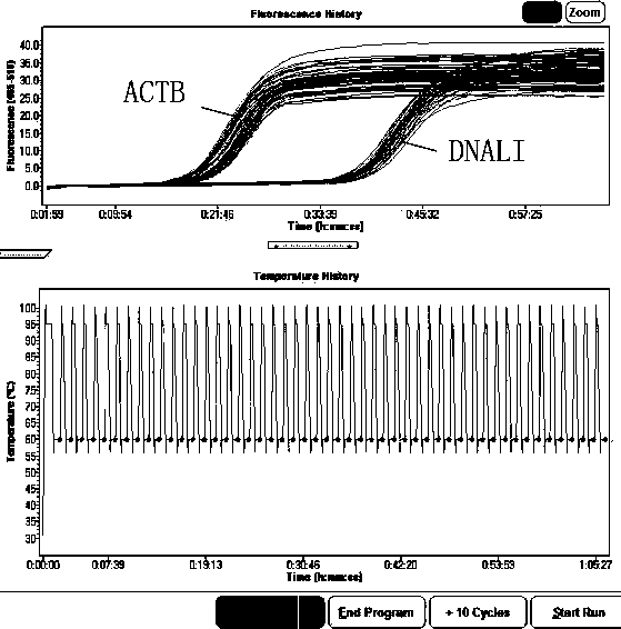 siRNA for interfering DNALI1 gene expression and application of siRNA in cell proliferation and migration inhibition