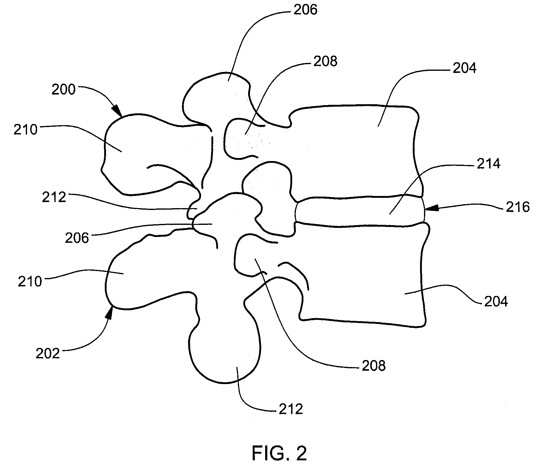 Compliant intervertebral prosthetic devices employing composite elastic and textile structures
