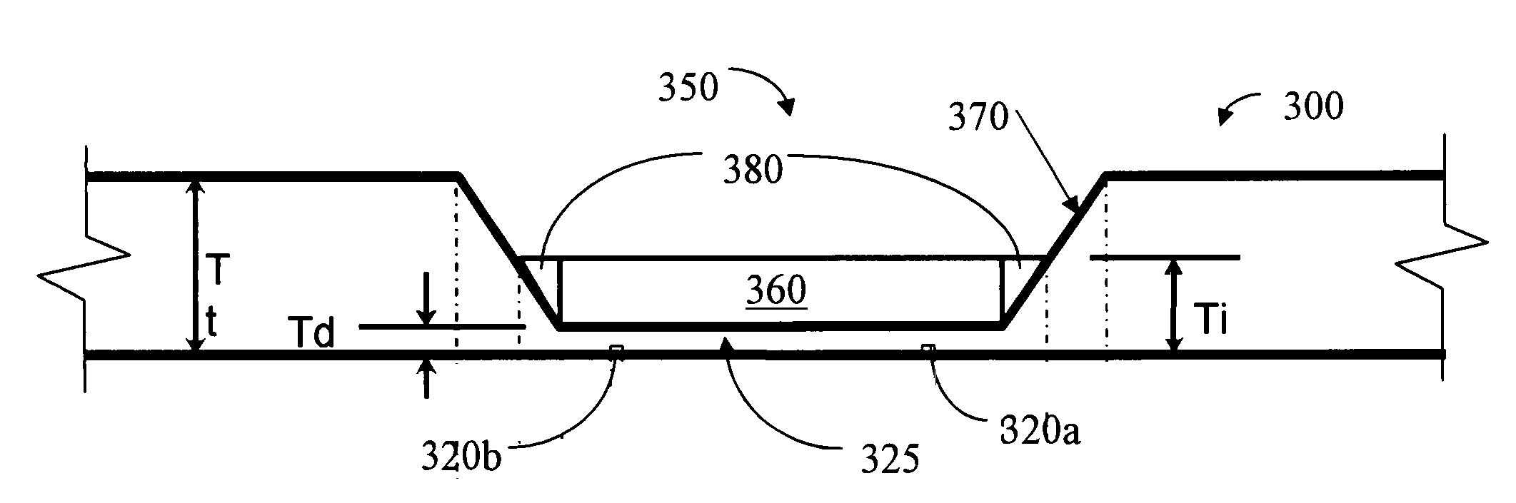 Method for local wafer thinning and reinforcement