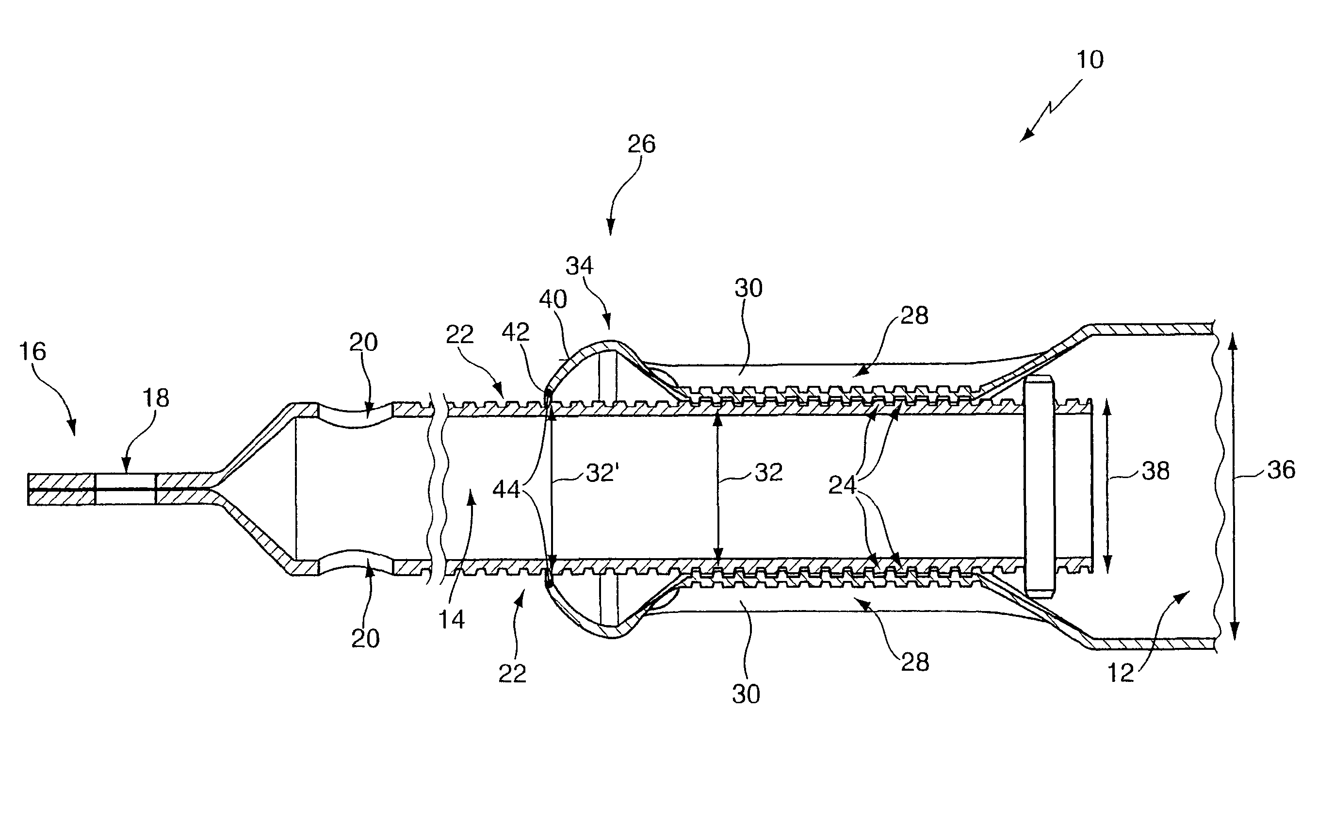 Telescopic structural support