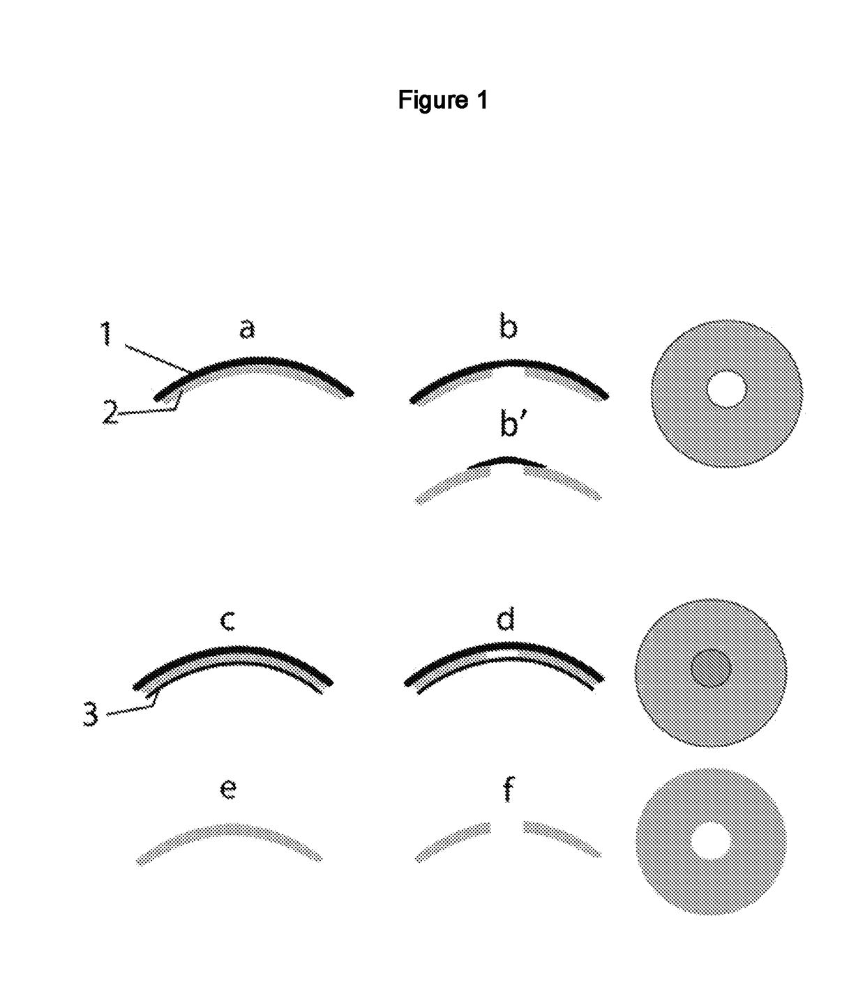 Ophthalmic Contact Lens with Compressible Affinity Matrix