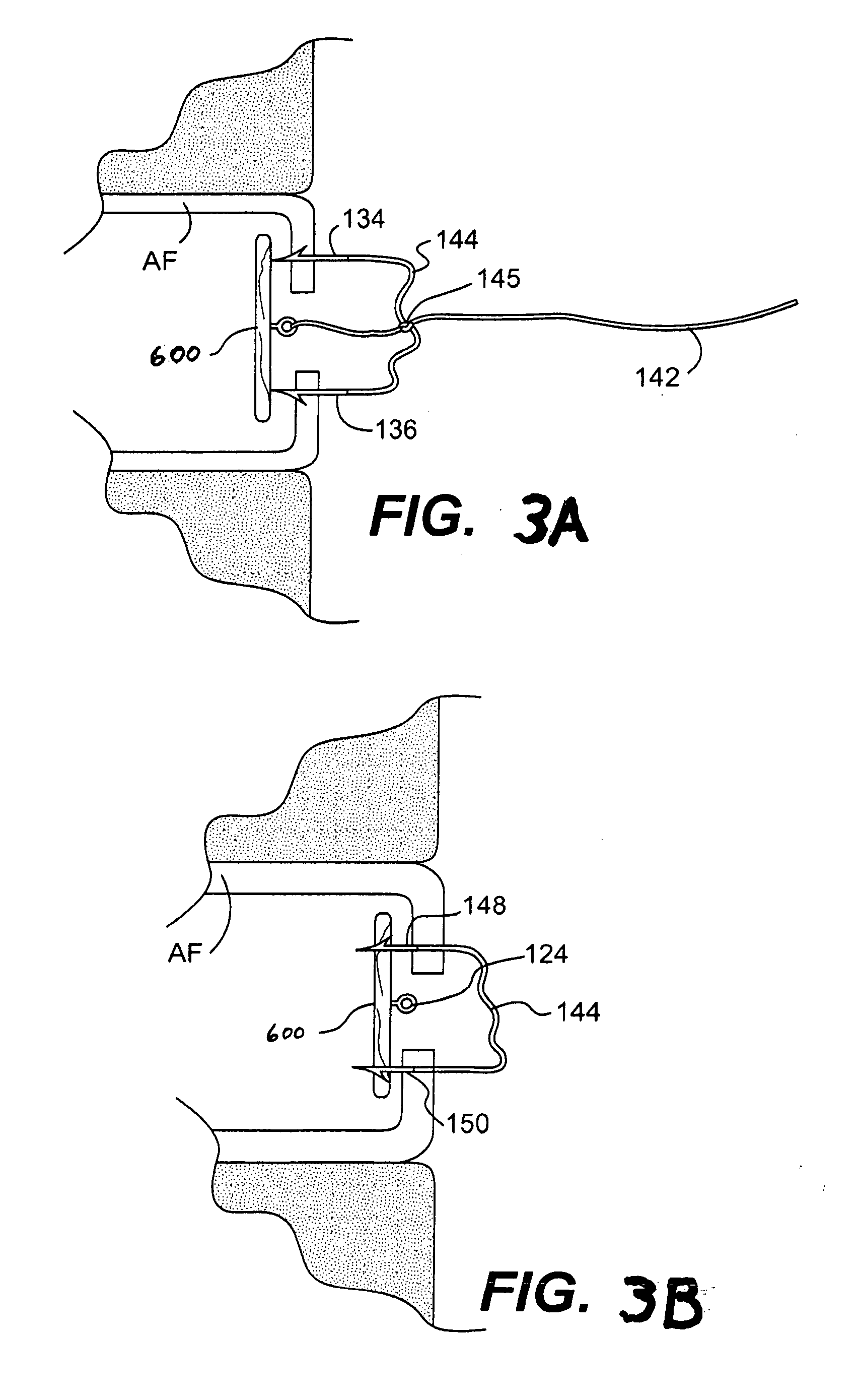 Apparatus and methods for the treatment of the intervertebral disc