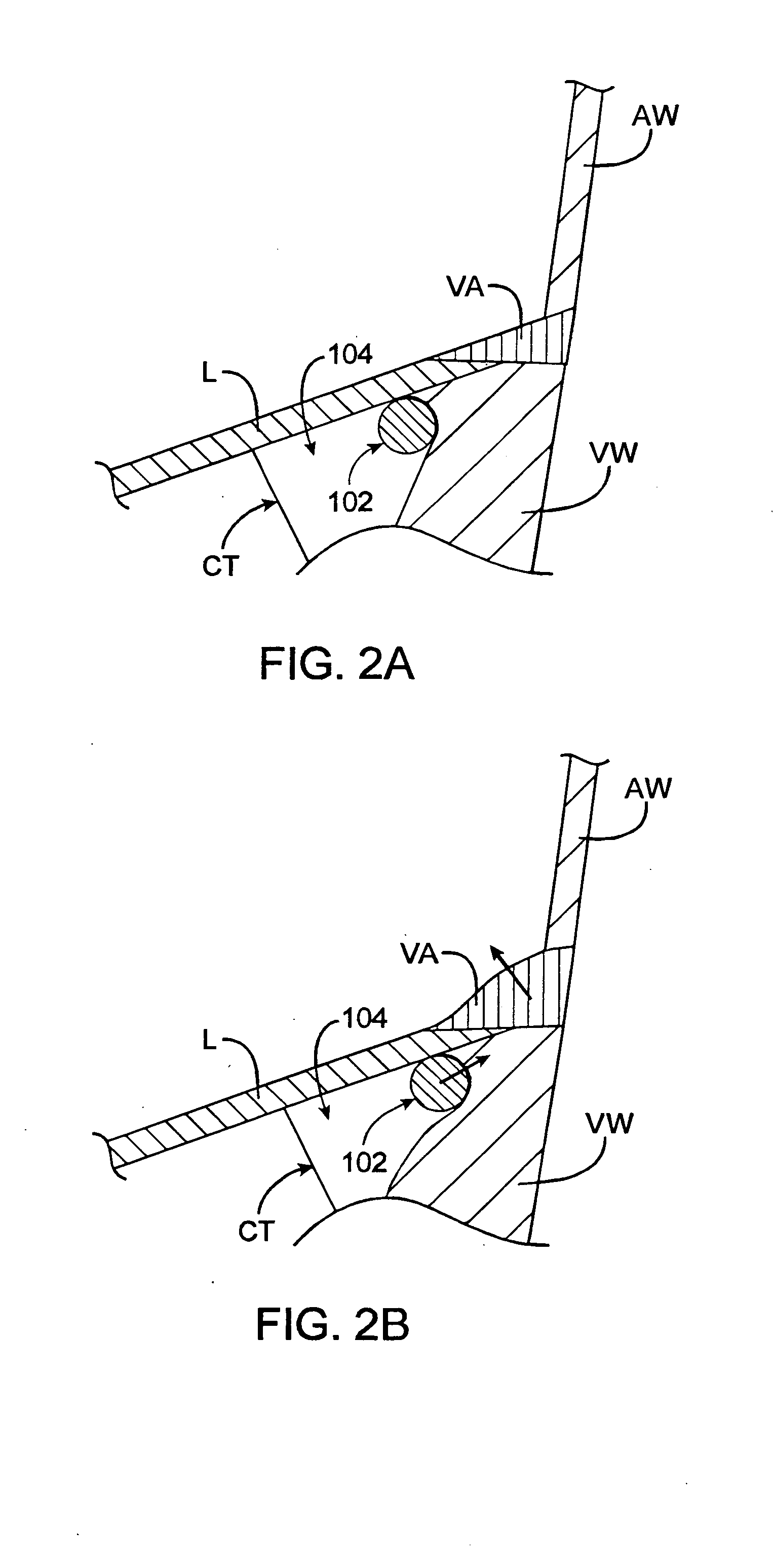Delivery devices and methods for heart valve repair