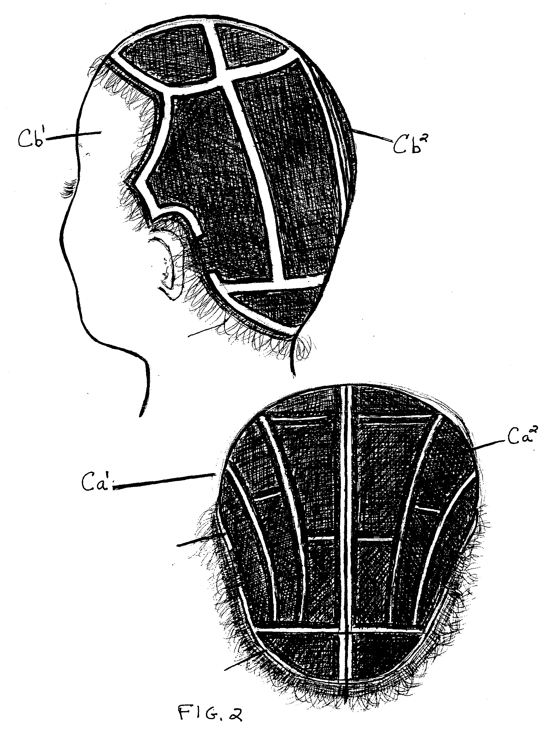 Interchangeable Wiglet with Anchor Cap Apparatus and Method