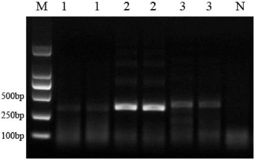 Primer pair, primers, probe composition, reagent and kit for detecting canine parvovirus based on BTNAA (Body Temperature Nucleic Acid Amplification) system