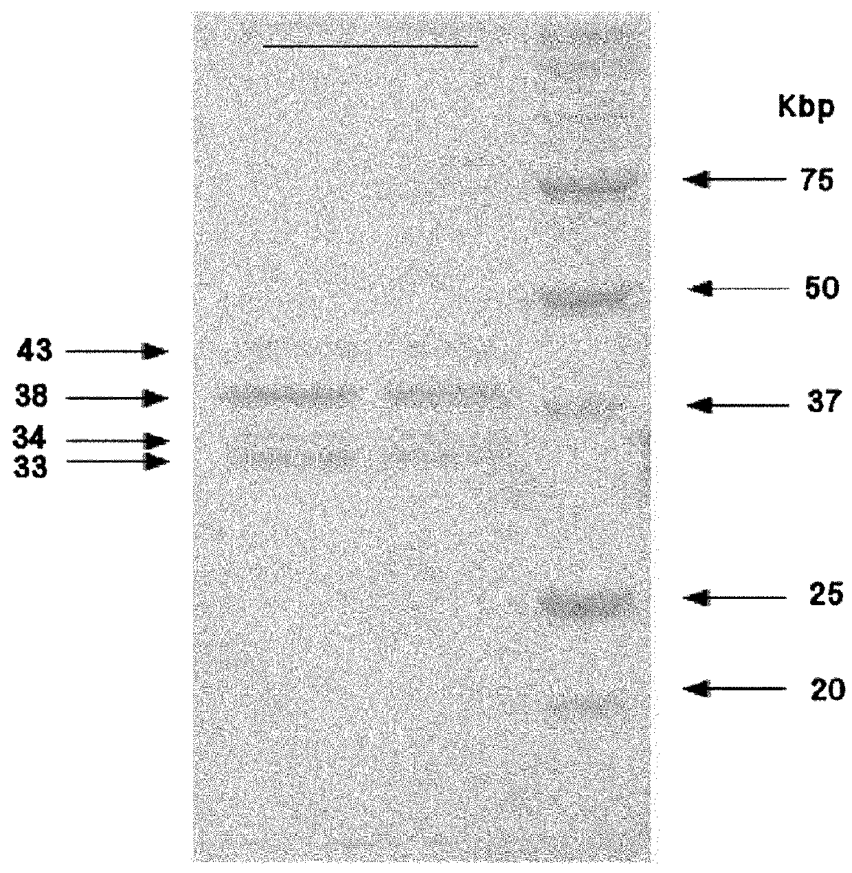 Isolated bacteriophage having <i>E. coli</i>-specific bactericidal activity and antibacterial composition comprising the same