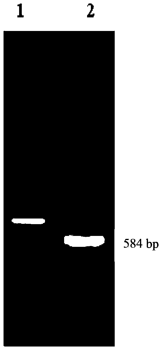 Hepatitis B virus surface antigen recombinant chimeric protein, preparation method and application thereof