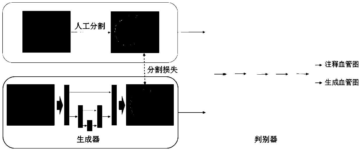 Fundus retinal vessel segmentation system based on enhanced generative adversarial network