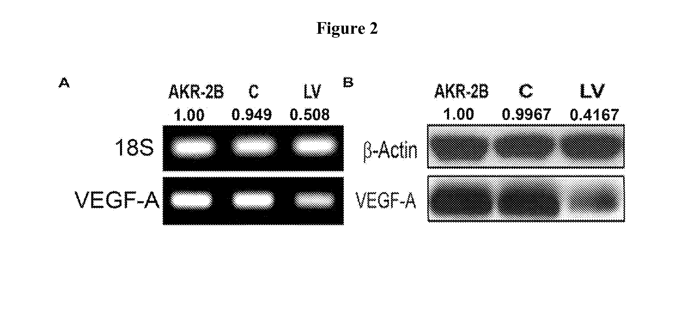 Methods and materials for reducing venous stenosis formation of an arteriovenous fistula or graft