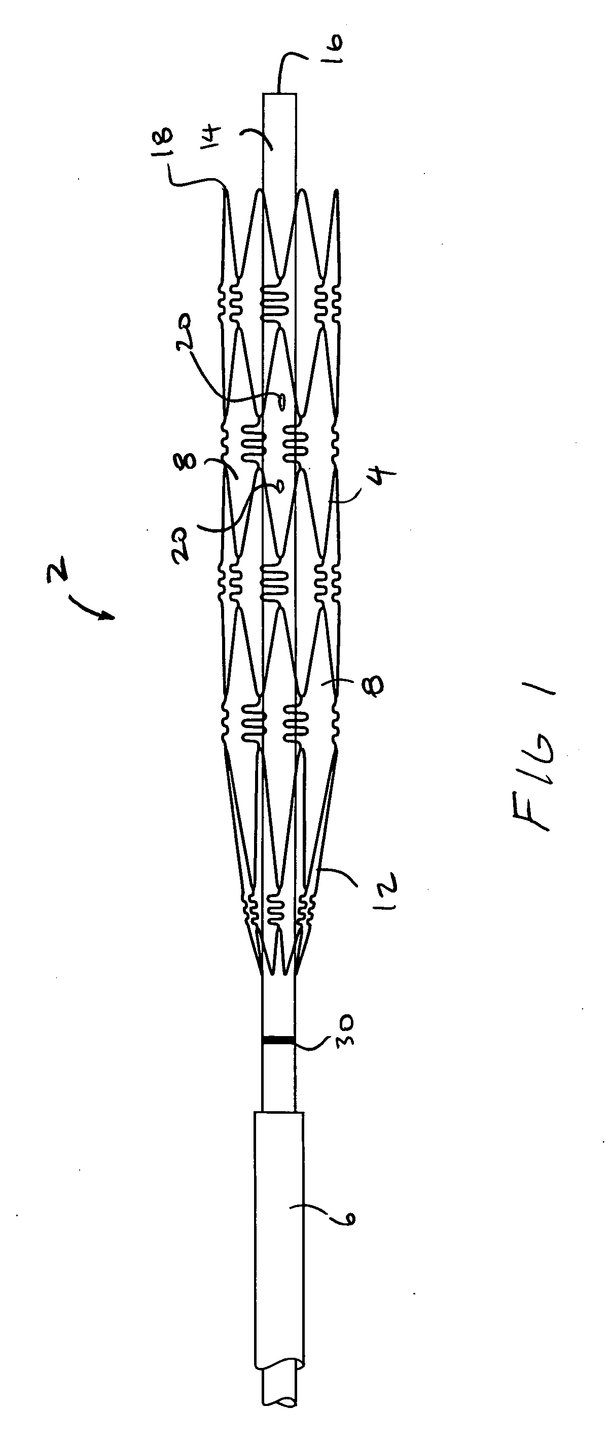 Devices and methods for temporarily opening a blood vessel
