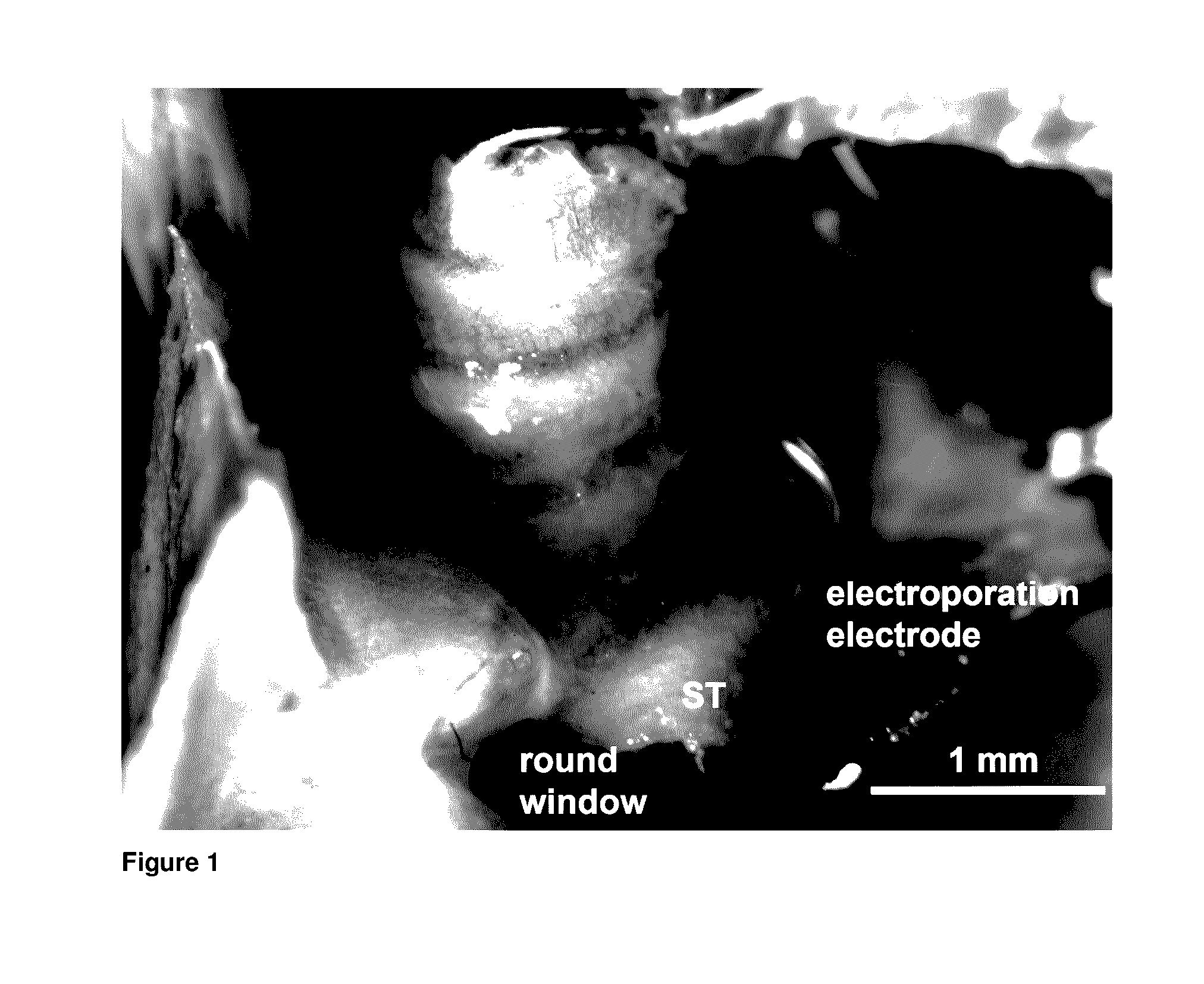 Method of providing agents to the cochlea