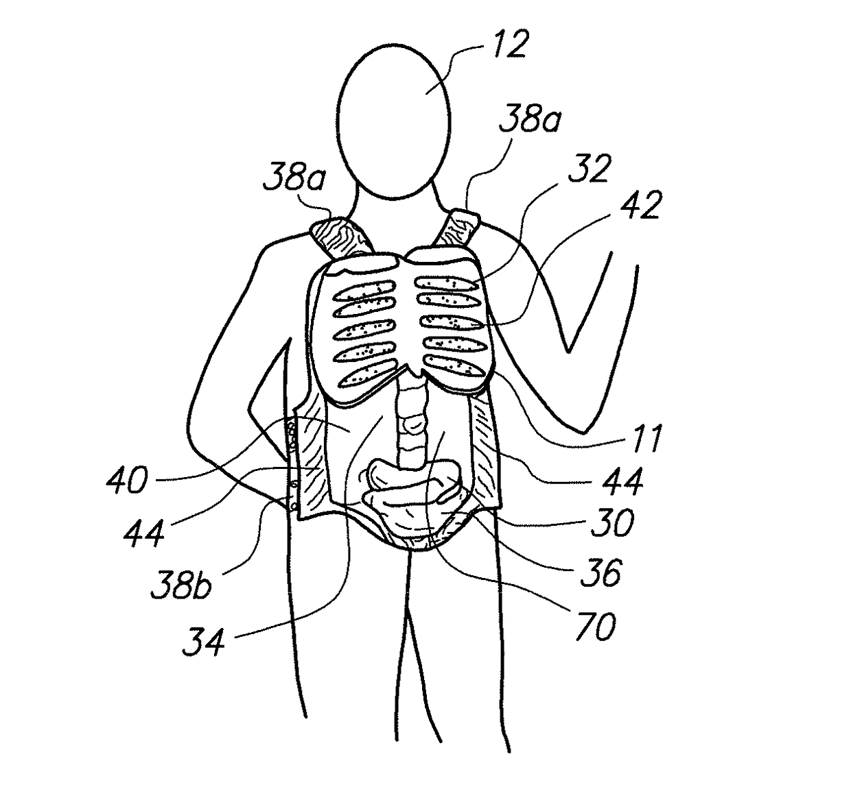 Wearable Partial Task Surgical Simulator