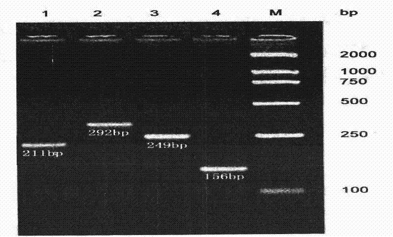 Chip for detecting human DNA repair enzyme genetic polymorphism and preparation thereof