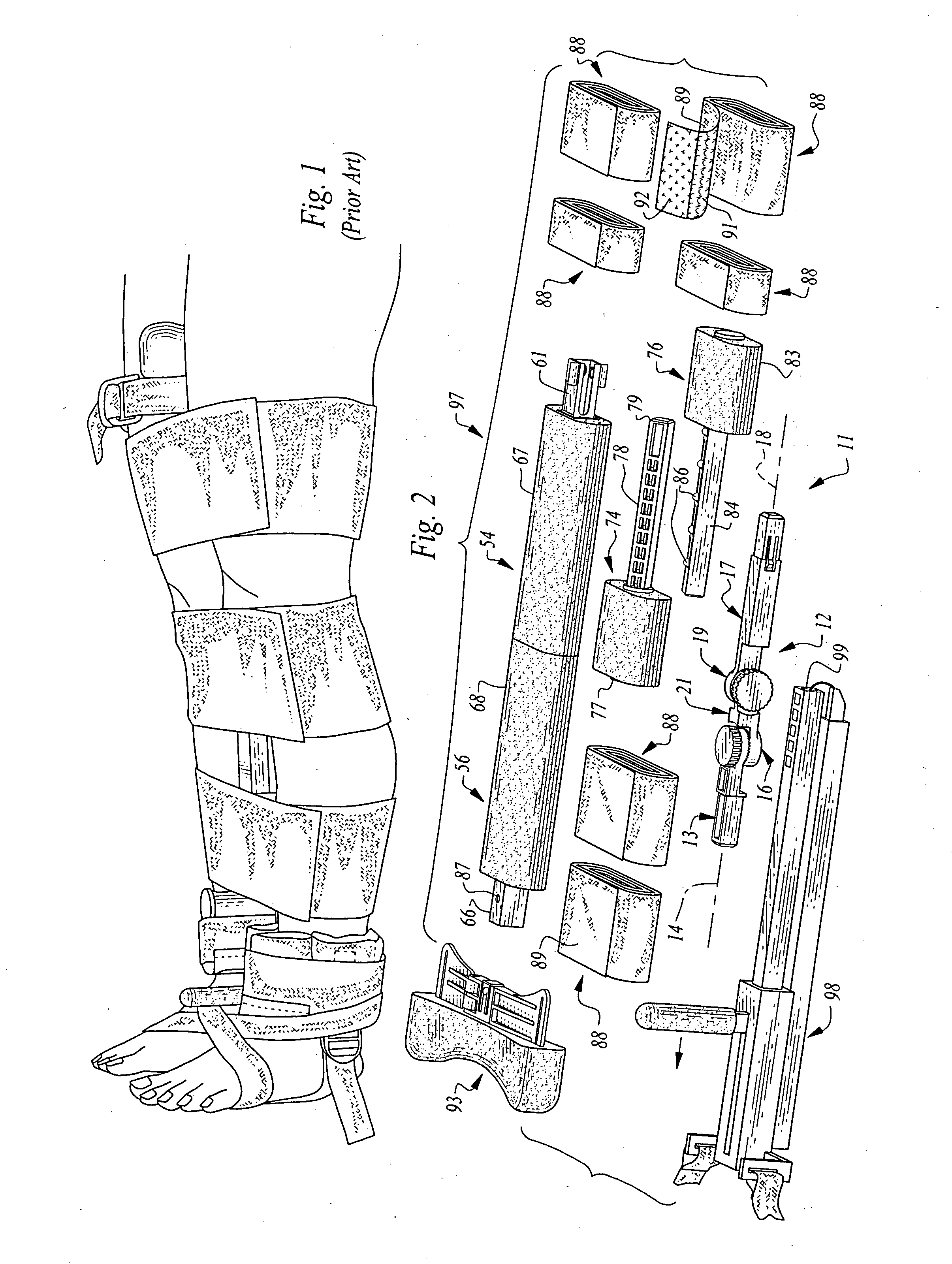 Medical splinting apparatus and methods for using same
