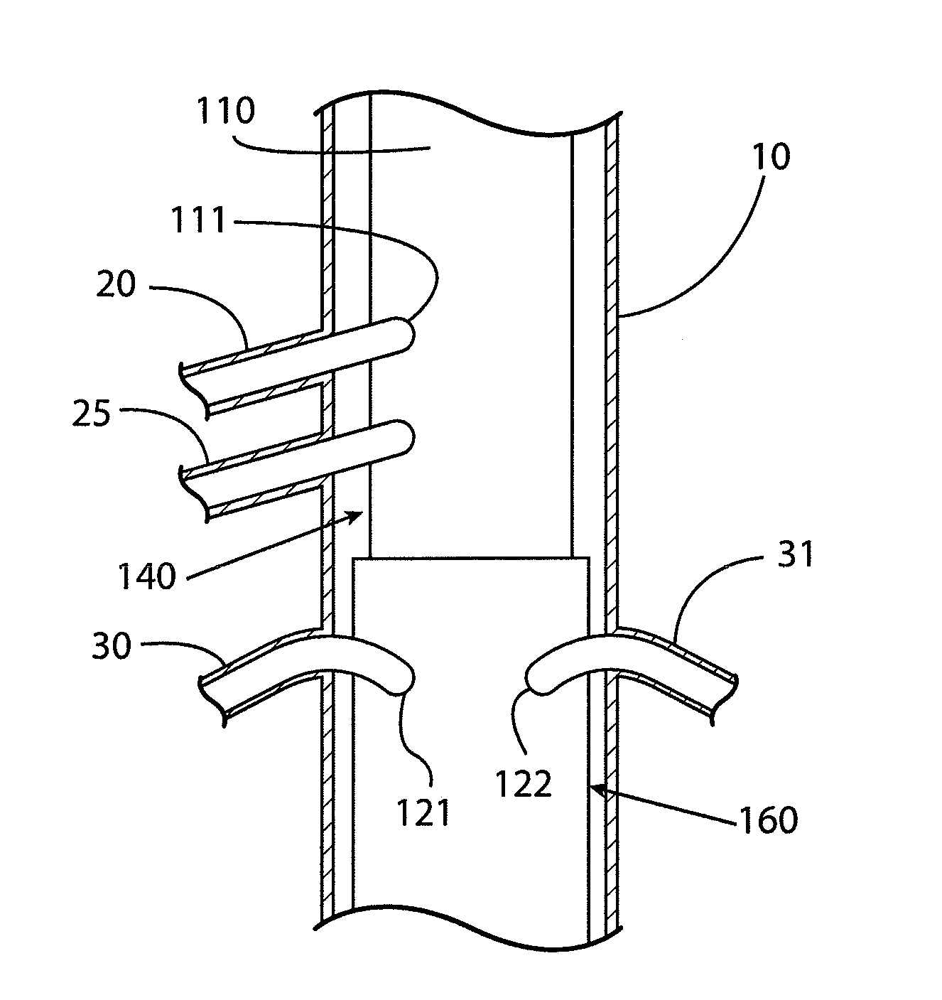Method and apparatus for endovascular therapy of aortic pathology