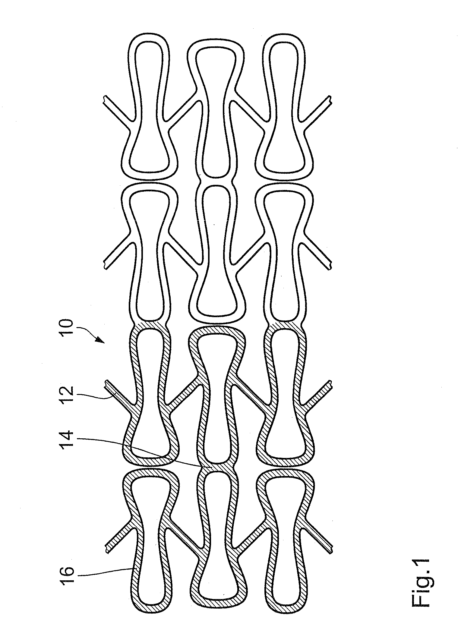 Endovascular implant with active coating