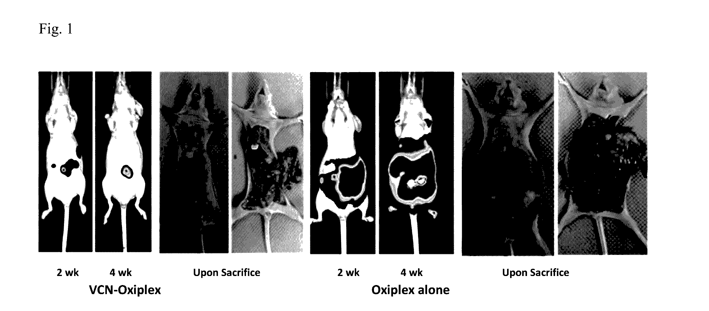 Compositions and methods for treating ovarian cancer including preventing the recurrence thereof