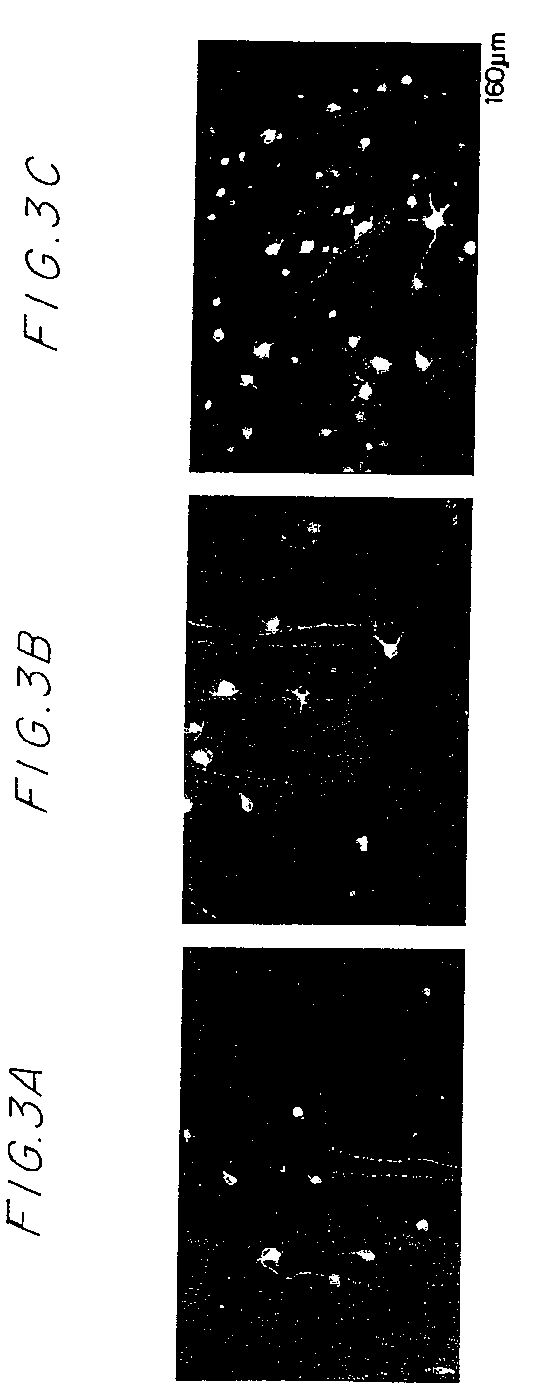 Method for reducing neuronal degeneration so as to ameliorate the effects of injury or disease