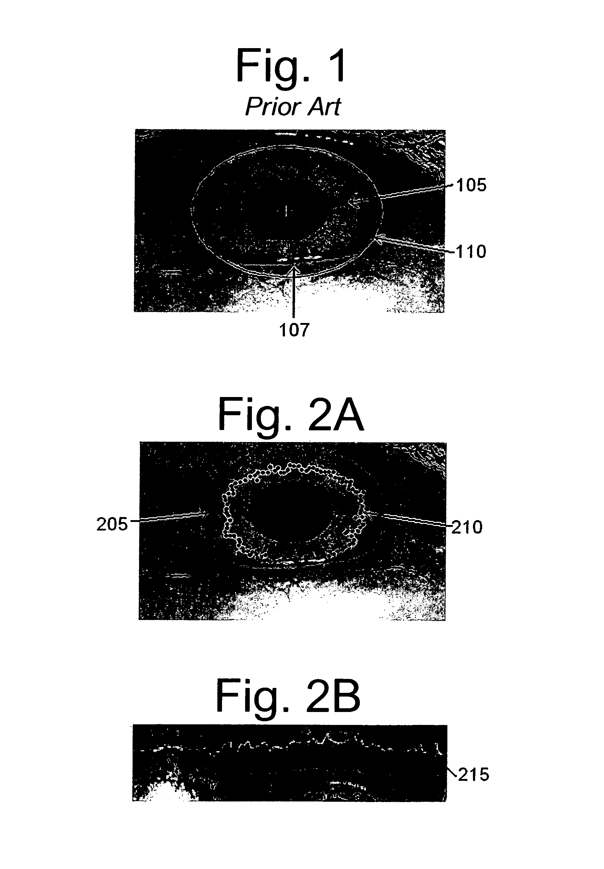 Invariant radial iris segmentation