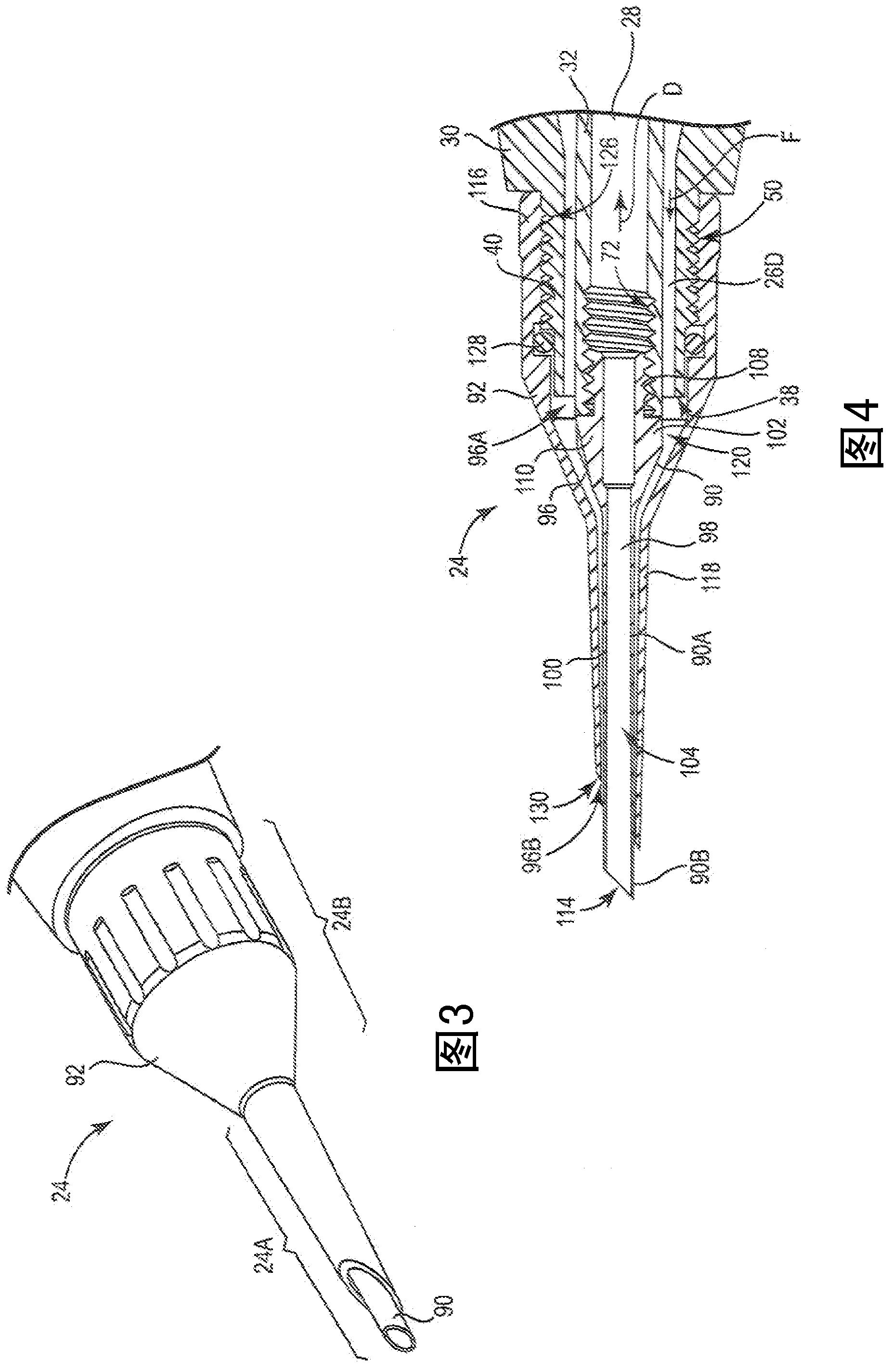 System and method for minimally invasive tissue treatment