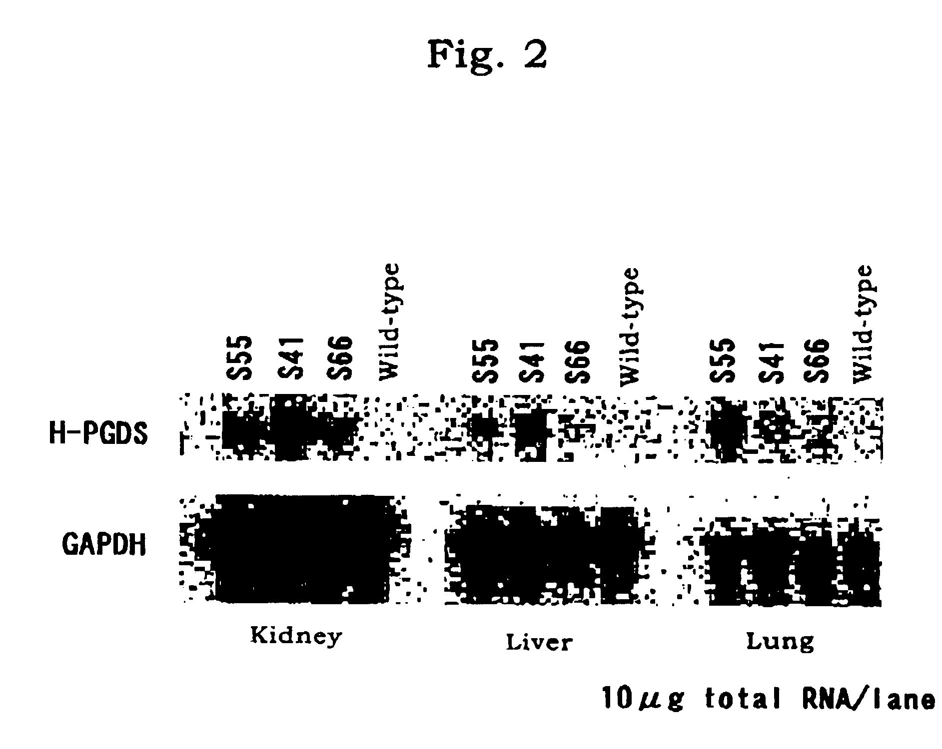Animal with the mass expression of human gene and test method by using the animal