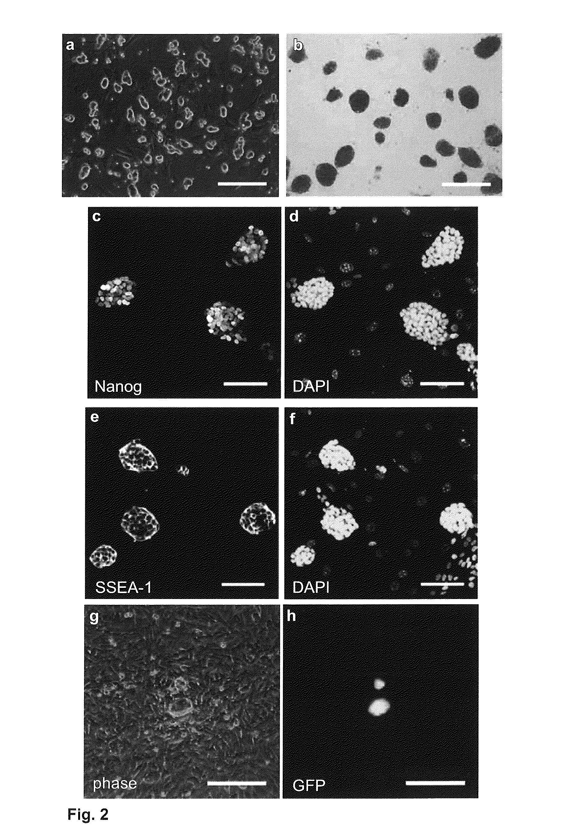 Method of effecting de-differentiation of a cell