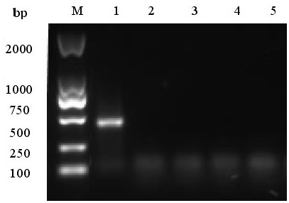 A kind of inactivated vaccine of goose astrovirus and preparation method thereof