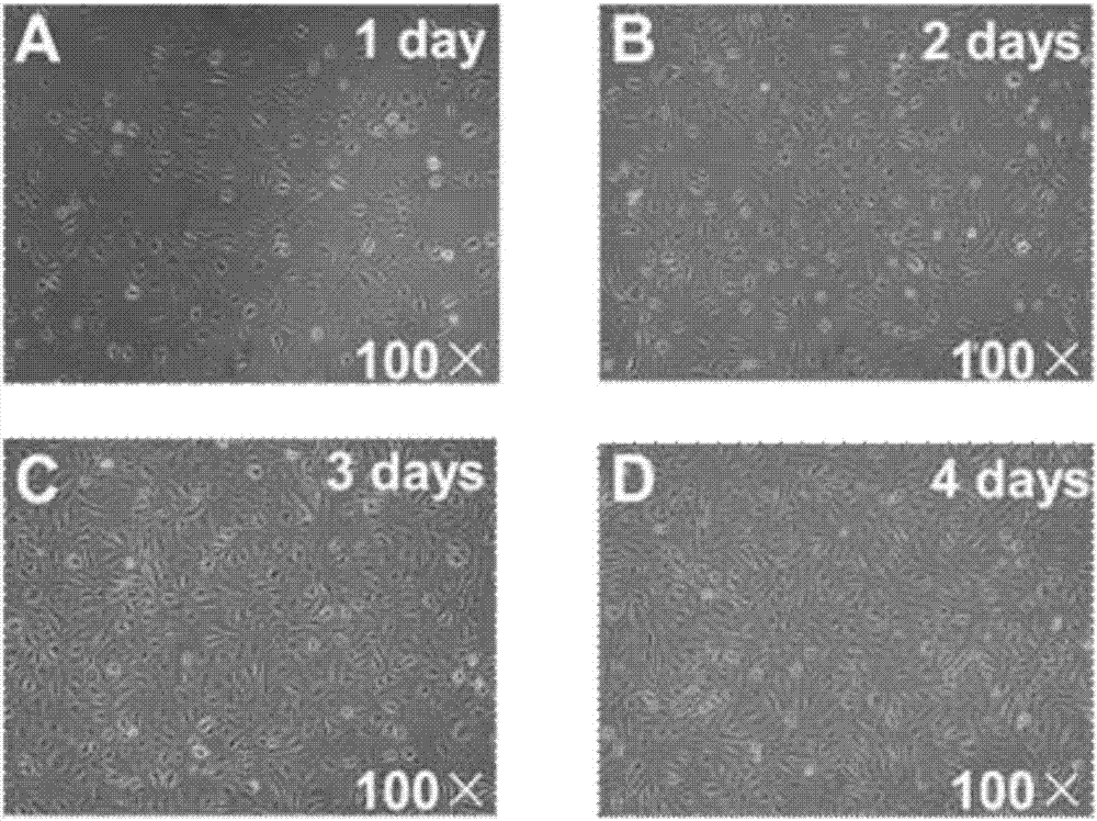 Immortalized dairy cow rumen endothelial cell line and construction method thereof