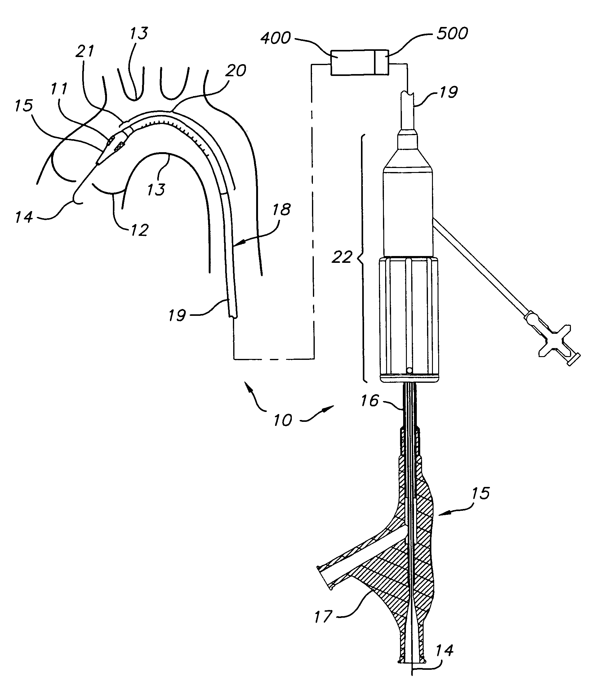 Heart valve delivery system