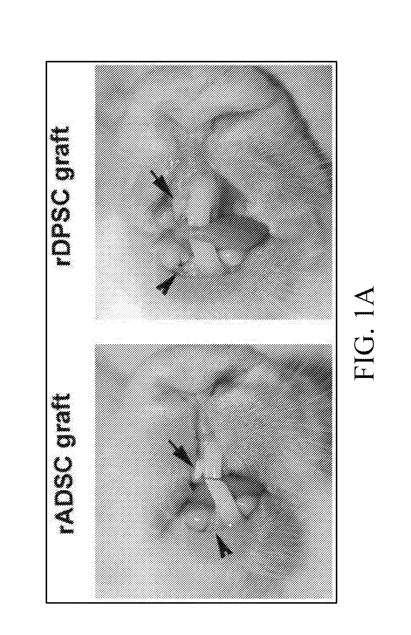 Method of implanting mesenchymal stem cells for natural tooth regeneration in surgically prepared extraction socket and compositions thereof
