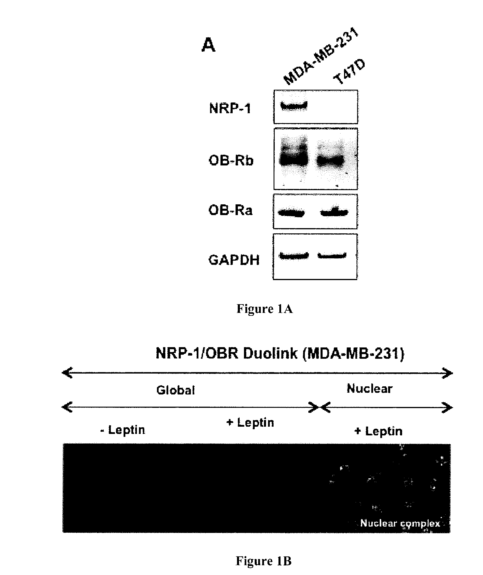 Methods and Pharmaceutical Compositions for the Treatment of Diseases Mediated by the NRP-1/OBR Complex Signaling Pathway