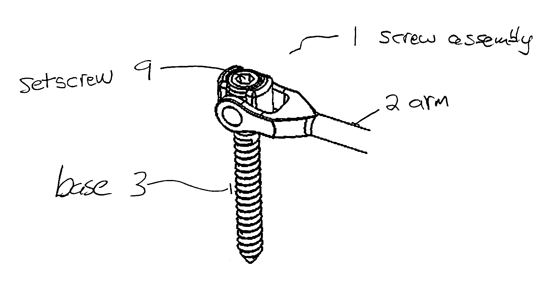 Pedicle screw assembly