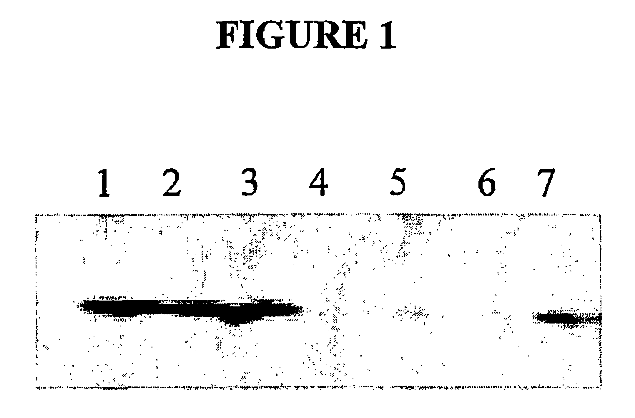 Compositions and methods for inhibiting an isoform of human manganese superoxide dismutase