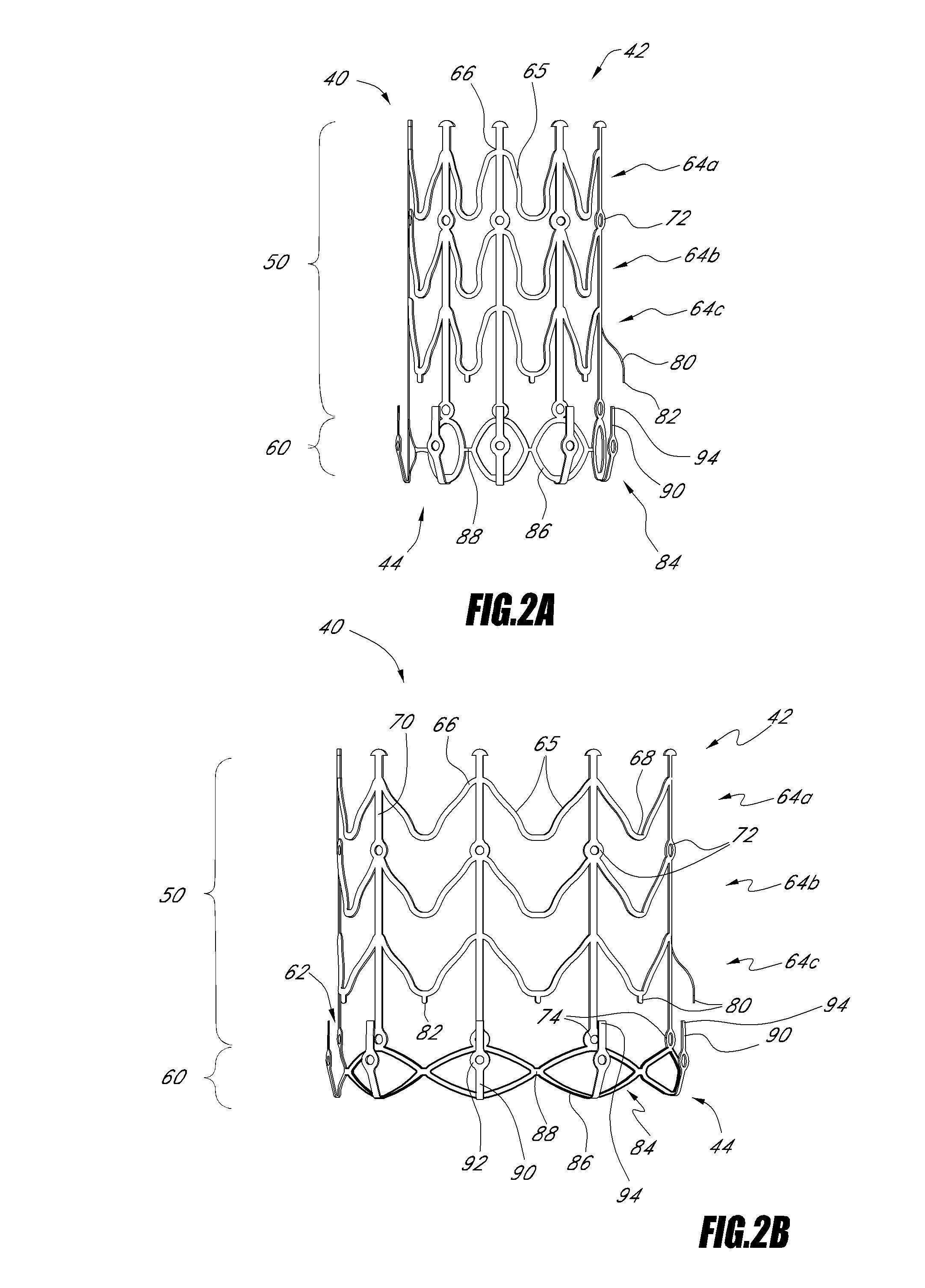 Vascular implant and delivery system