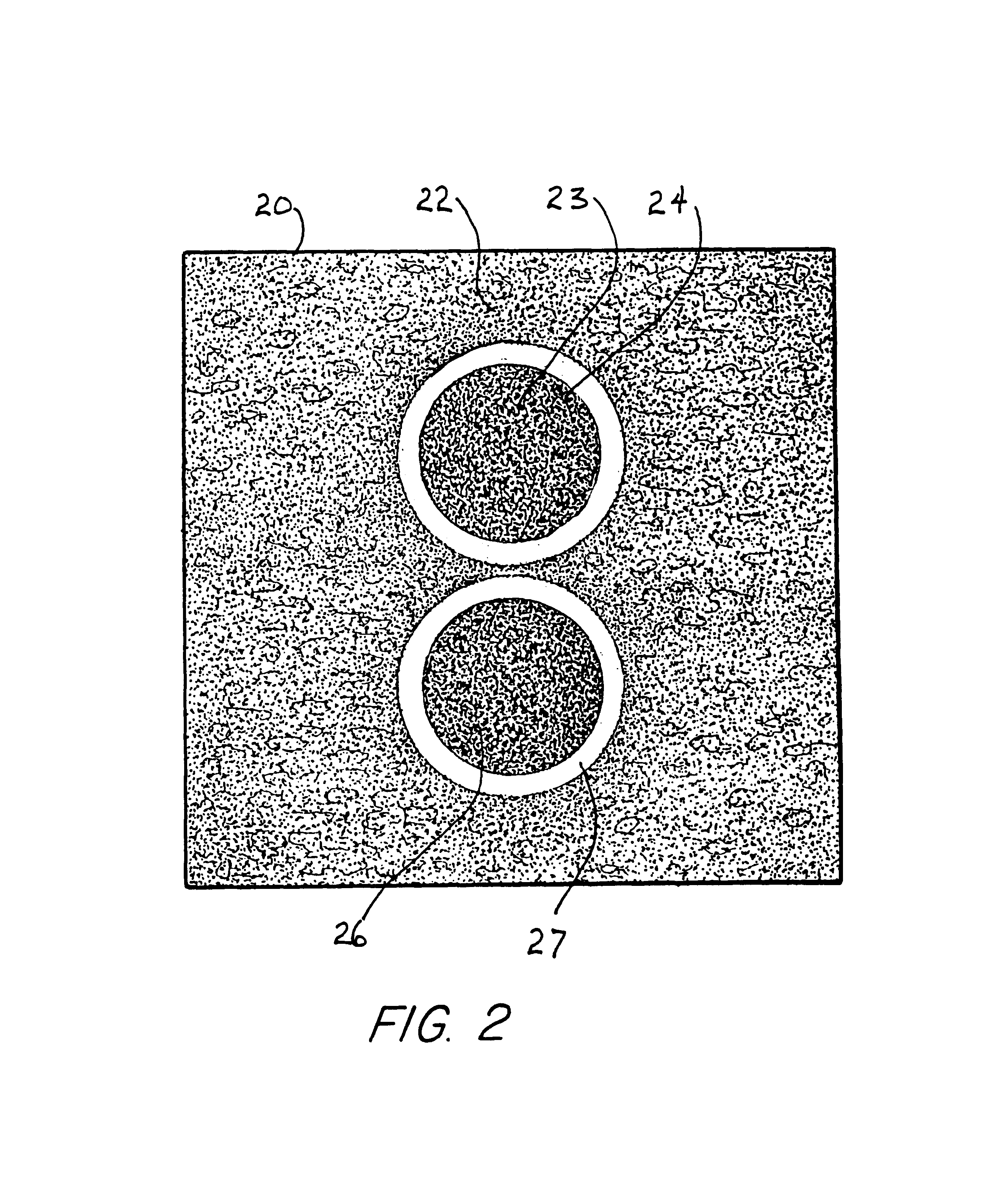 Split-screen display system and standardized methods for ultrasound image acquisition and processing for improved measurements of vascular structures