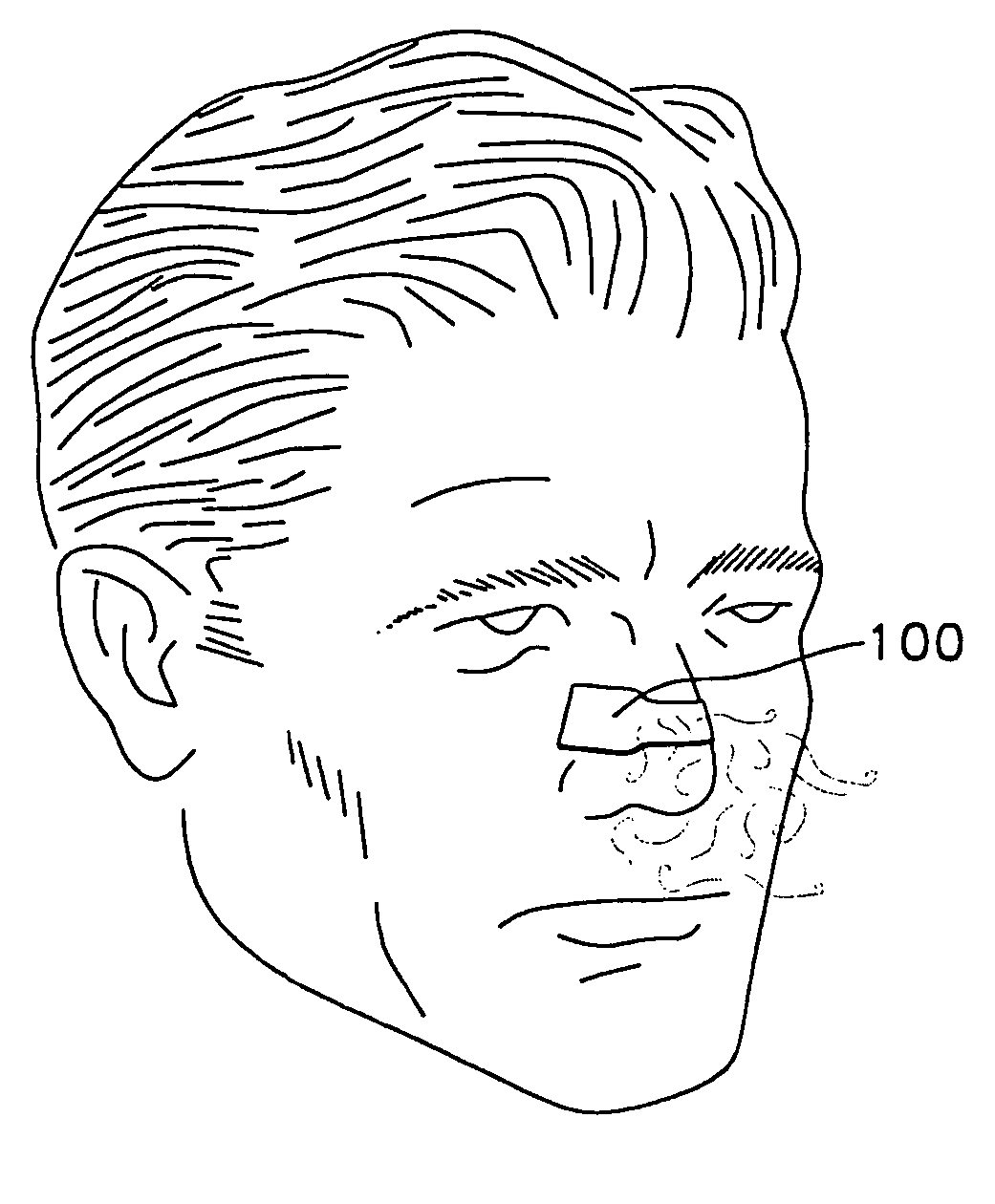 Adhesively applied external nasal strips and dilators containing medications and fragrances