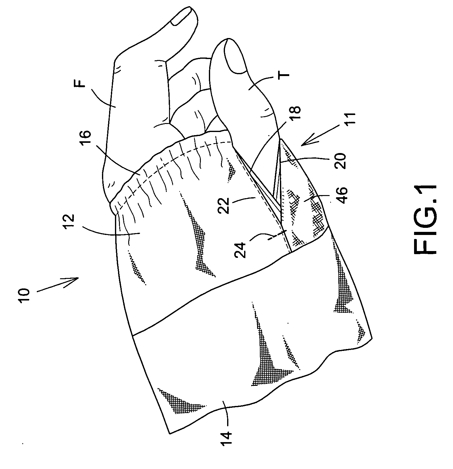 Garment element with an access opening