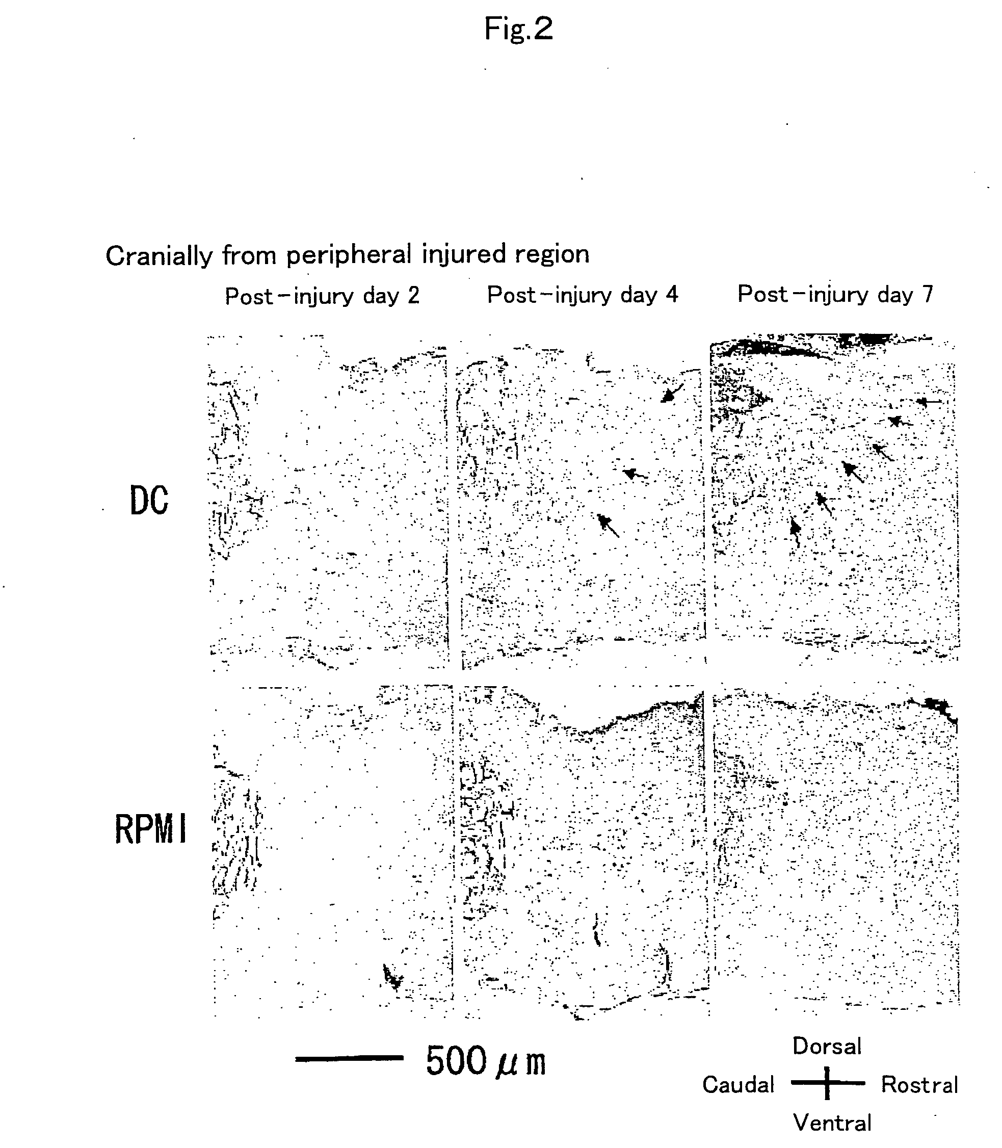 Method of inducing growth of nerve stem cells