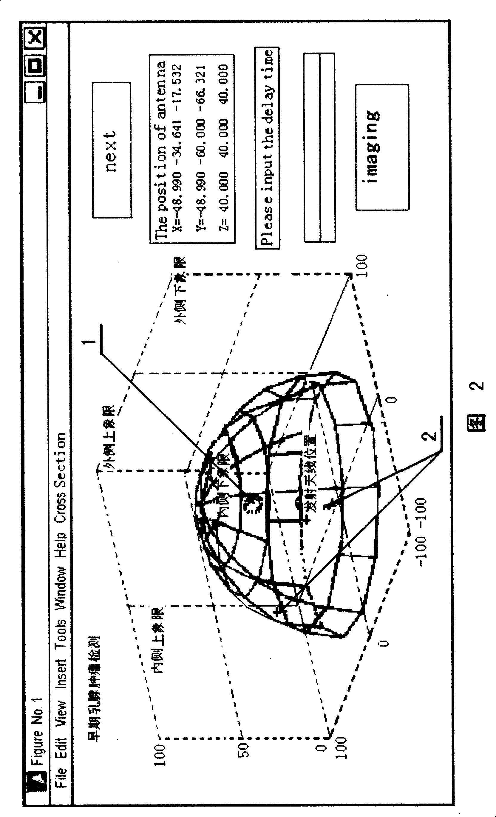 Microwave near-field medicine body detecting method and use thereof