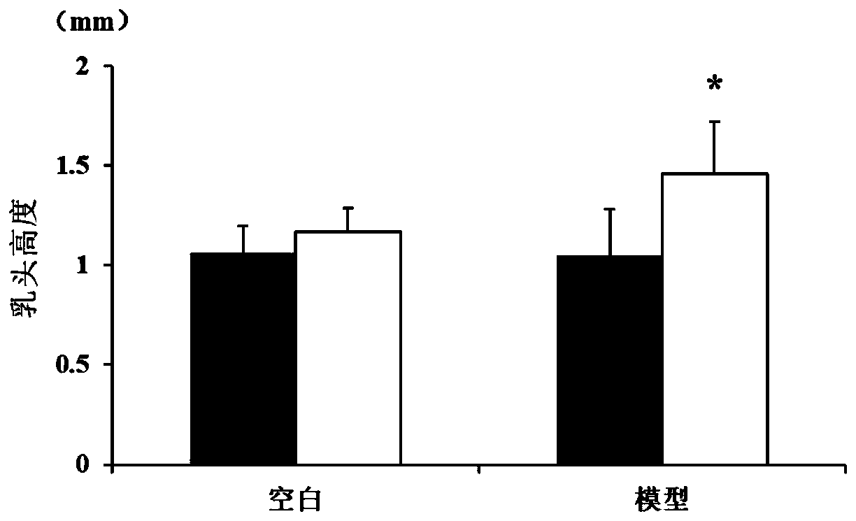 Traditional Chinese medicine compound preparation for treating sores and ulcers and unknown pyogenic infections as well as preparation method and application thereof