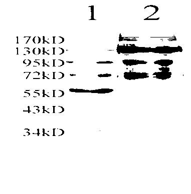 Apolipoprotein B nano antibody and coding sequence and application thereof