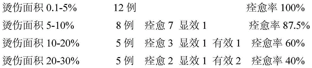 Chinese medicine composition used for treating scalds and preparation method thereof